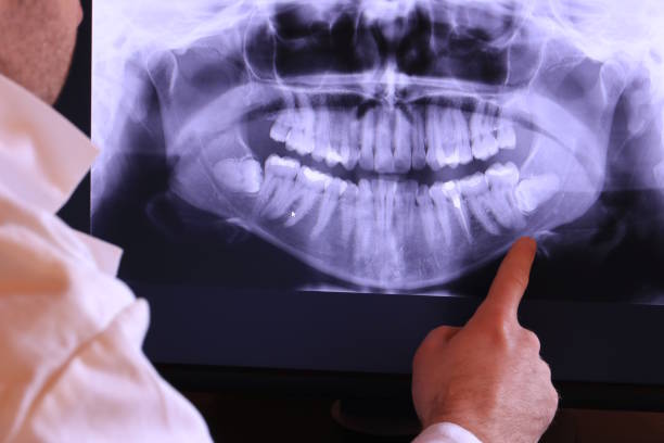 Best Emergency Dental Care for Broken or Chipped Teeth in Gallatin, MO