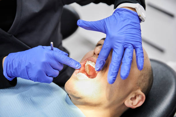 Best Emergency Gum Treatment in Gallatin, MO