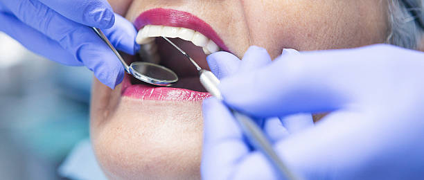 Best Emergency Treatment for Dental Infections or Abscesses in Gallatin, MO